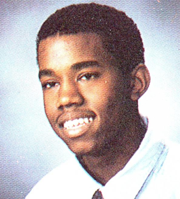 Kanye West before dental work